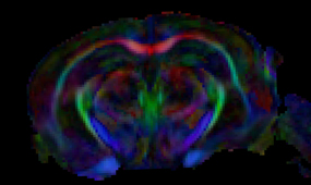 DTI of Mouse Brain.