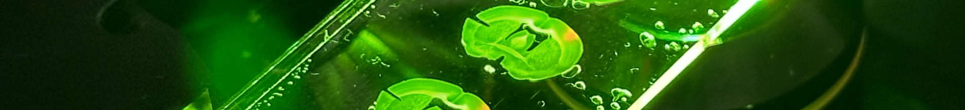 Spinning Disk Confocal Olympus IXplore-Spin